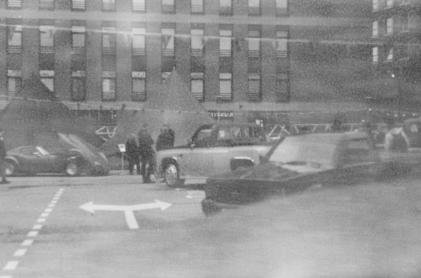 L'épilation laser du visage : la clé d'une peau sans poils